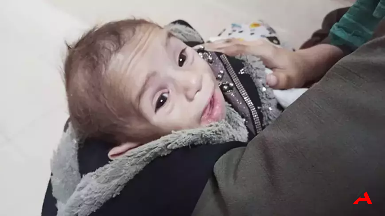 Gazze’de 277 Gün: 38 Bin Ölü, 88 Bin Yaralı
