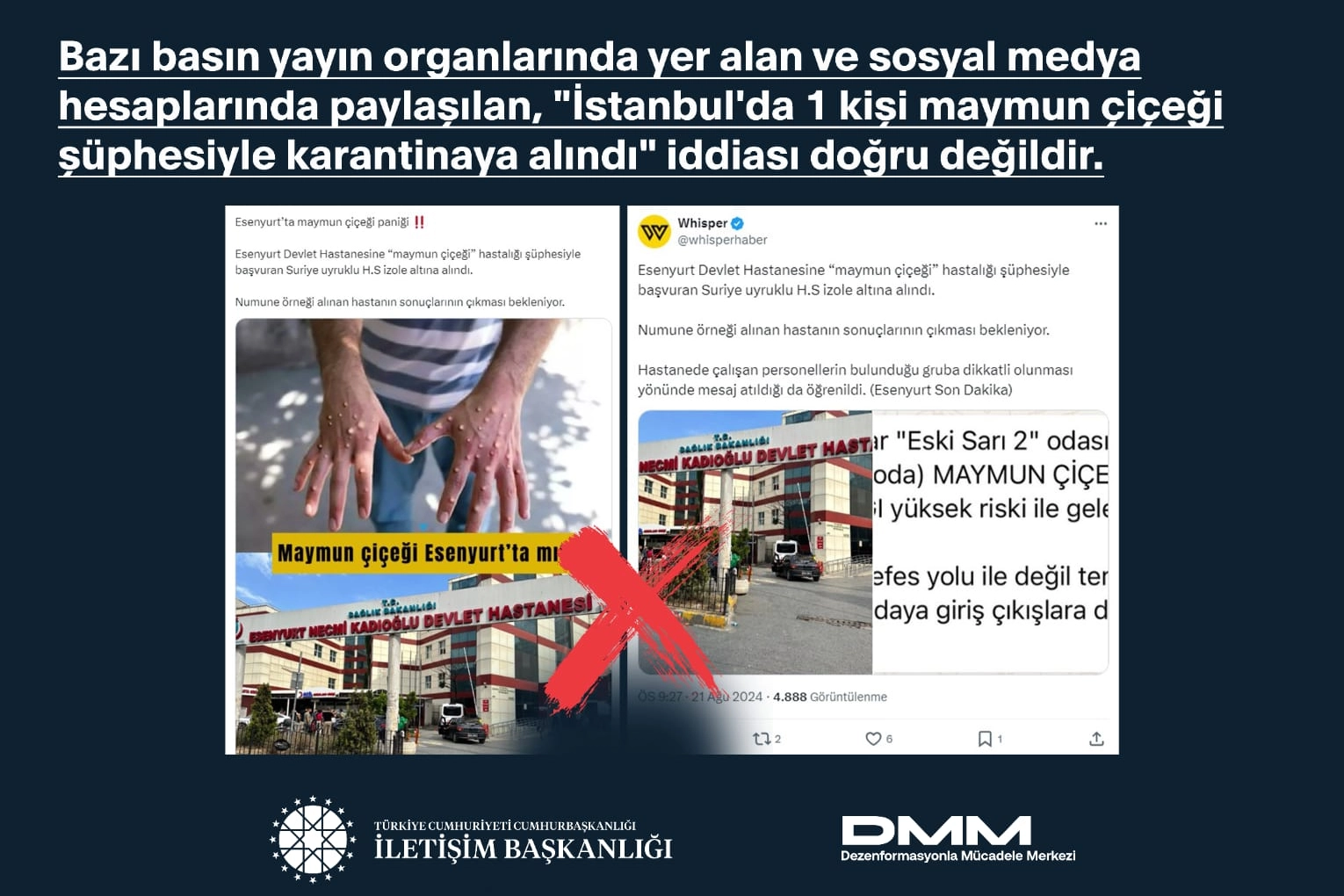 Maymun Çiçeği’nin Türkiye İddiaları Dezenformasyondan İbaret